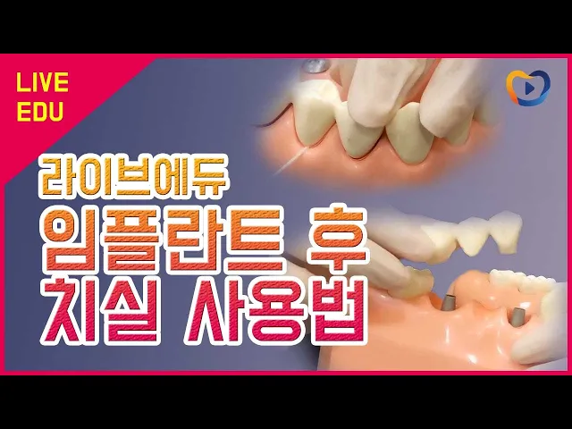 [라이브에듀]  임플란트 치실사용으로 수명연장!