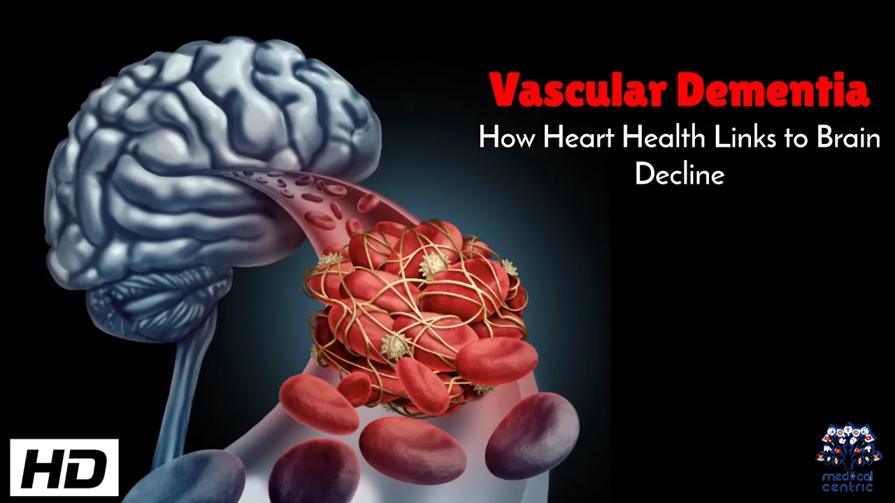 Vascular Dementia : How Heart Health Links to Brain Decline
