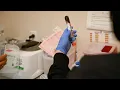 P R P Injection Therapy for Hair Loss