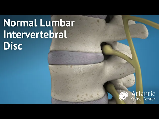 Normal Lumbar Intervertebral Disc