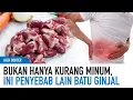 Download Lagu Berbagai Penyebab Batu Ginjal Terbentuk, Kebiasaan dan Makanan! | Kata Dokter
