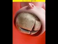 Why is the skull of a newborn baby open
