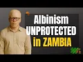 Zambia s Albinism Crisis Fear Myths and the Fight for Protection
