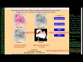 SKIN DISEASE DETECTION USING CNN PROJECT WITH SOURCE CODE SKIN DISEASE IDENTIFICATION PYTHON CODE