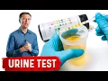 Urine Test Simplified
