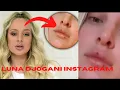 Download Lagu Why Luna Djogani has sores on her mouth | Luna Djogani instagram