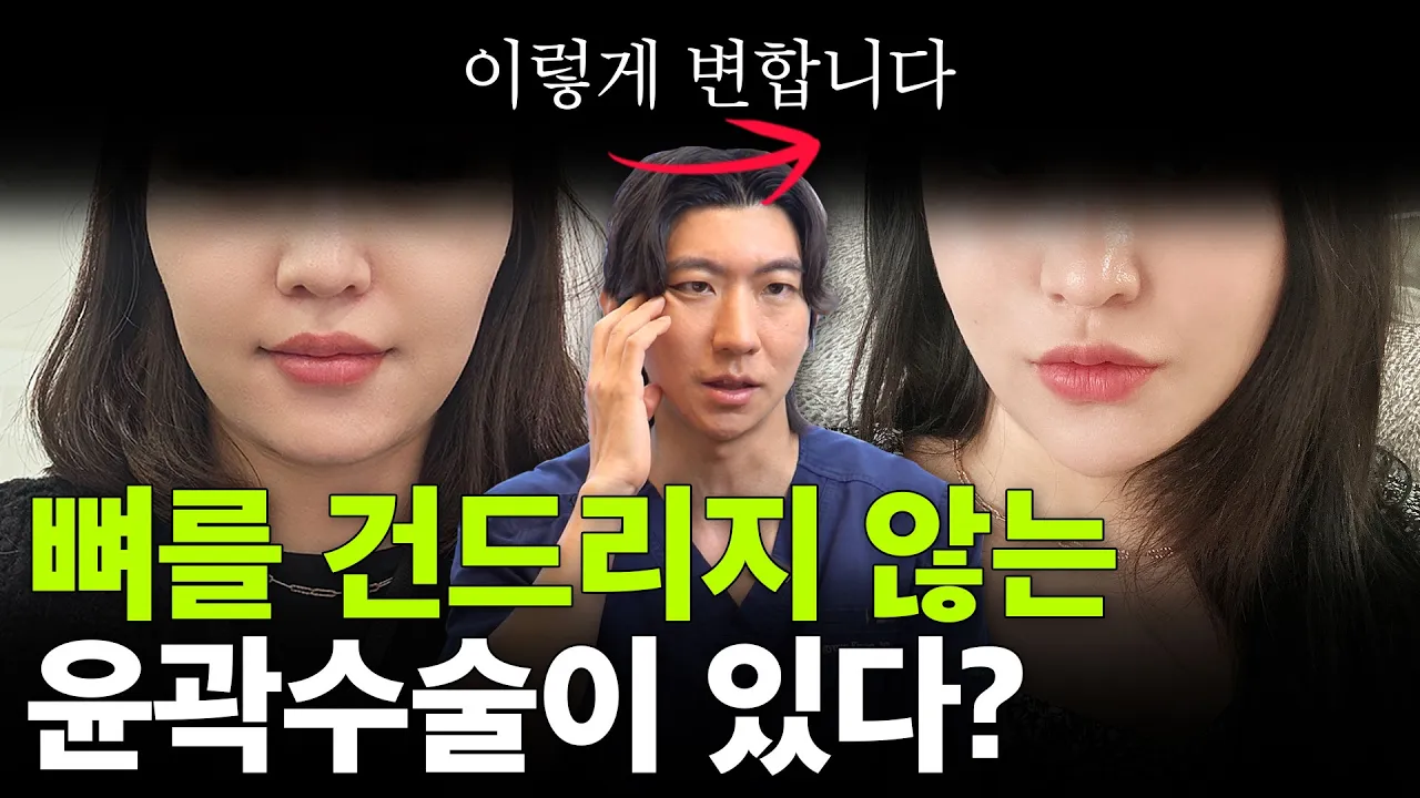 뼈를 건들지 않는 윤곽수술이 있다?💀🦴ㅣ연조직 윤곽술 알려드립니다! (feat. 내 얼굴에 맞는 수술법은?)