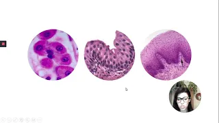 Hematoxilina-eosina