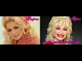 Dolly Parton Before and After Plastic Surgery