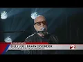 Doctor weighs in on Billy Joel brain disorder diagnosis