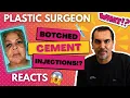 Cement Injections Plastic Surgeon Bill Aydin Reacts