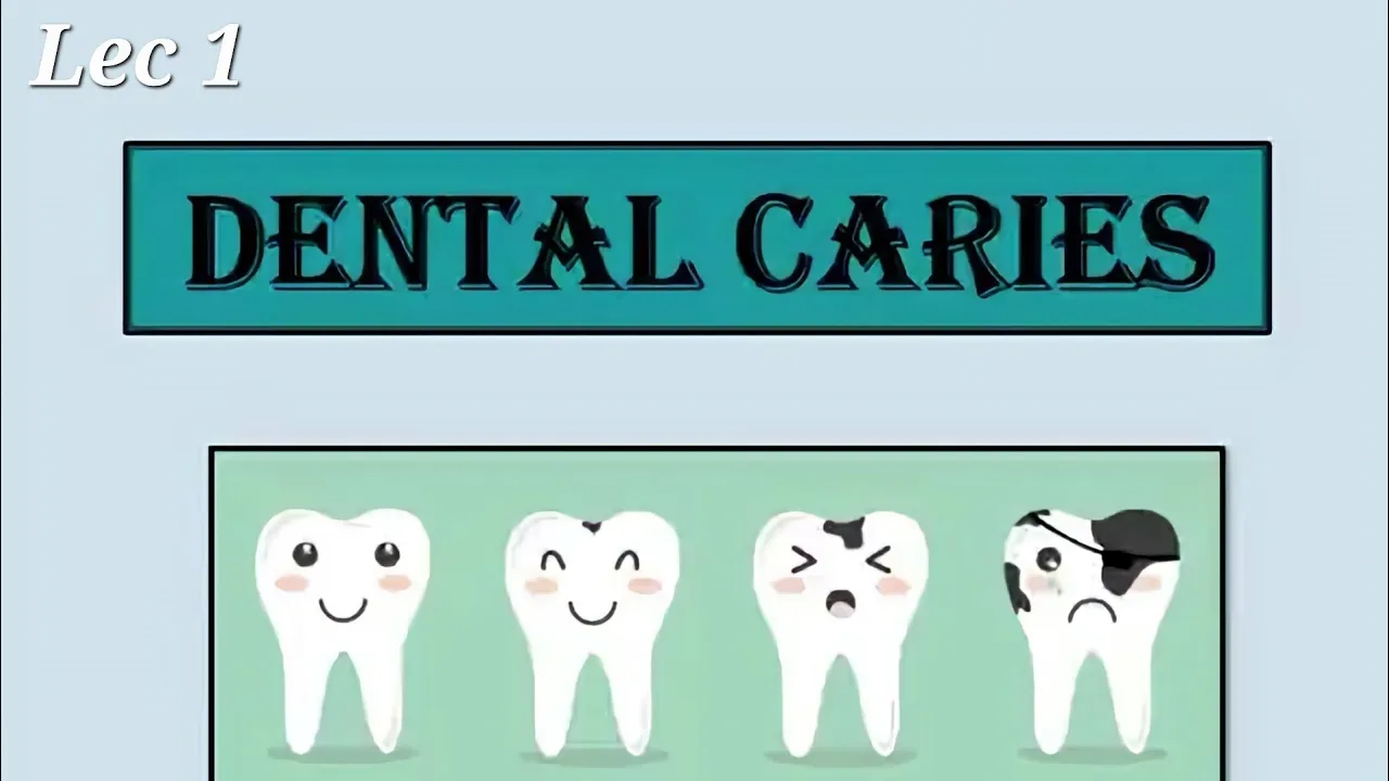 Oral Pathology 1 ; Lec 1 ; Dental Caries