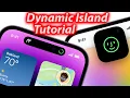 Lagu Hoe u de functies van Dynamic Island gebruikt - Dynamic Island uitgelegd