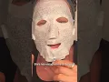 Part 1 Radio-frequency and Micro-needling at Aura Medical spa in Tysons corner Vienna Va