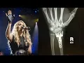 Carrie Underwood Opens Up About Face-Scarring Fall It Just Wasn t Pretty