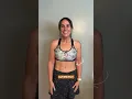 Major Weight Loss meets Sono Bello s Skin Removal AbEX