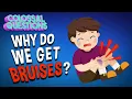 Why Do We Get Bruises COLOSSAL QUESTIONS