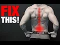 How to Fix a Bulging Disc NO SURGERY