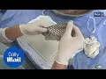 Trans woman given world's first vagina made from tilapia fish skin