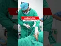 Download Lagu Axillary Fat Removal #short #shorts #Shortvideo #AxillaryFatRemoval #AxillaryFat #Axillary #Fat
