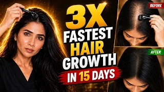पतले बालों को 15 Days में 3X मोटा और घना करने का Science- Dermarolling for 3X Faster Hair Regrowth