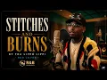 ❤️ STITCHES AND BURNS | Soulful R&B Cover (Fra Lippo Lippi)