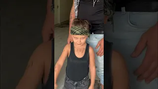 الطفل الازعر  الطفل الازعر