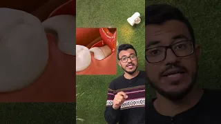 خلع ضرس العقل    دندنها