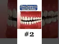 Braces check