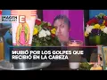 Norma Lizbeth era acosada por su color de piel