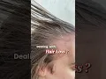 The most important step when dealing with HAIR LOSS