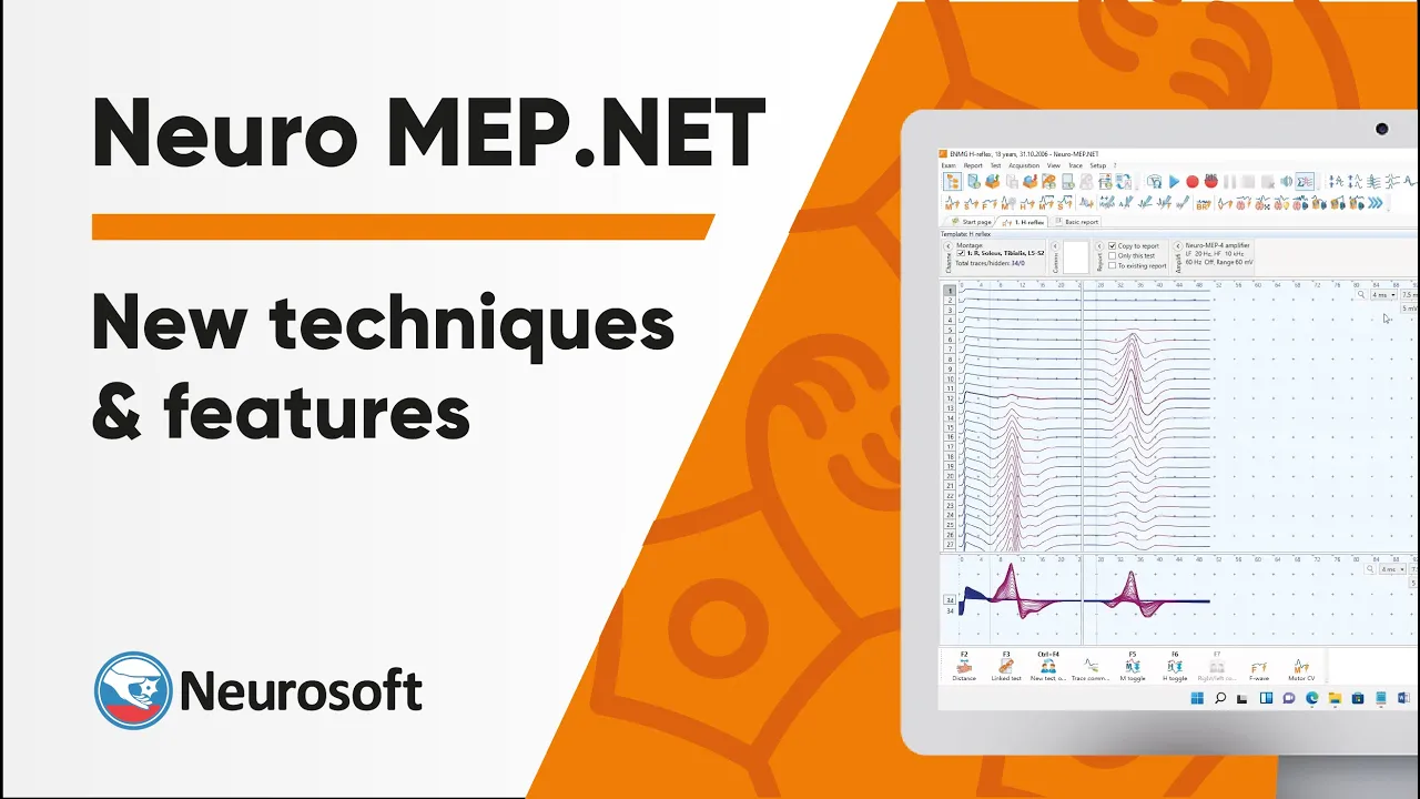 New techniques and features in «Neuro MEP.NET» program