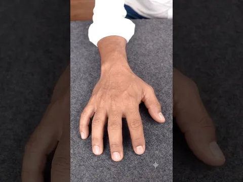 Haku Virus 🦠 || Pink क्या था Haku #Shorts #youtubeshorts #trending #viral #foryou