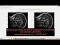 MRI Compression using Wavelets Compressed Sensing MATLAB Project Electrical Assignment