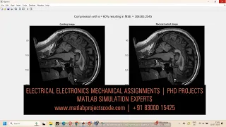 MRI Compression using Wavelets Compressed Sensing MATLAB Project Electrical Assignment