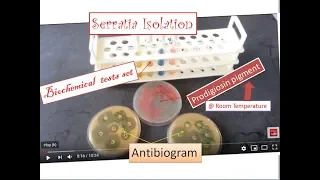 Serratia the simplest way of identification and isolation from specimens Serratia marcescens