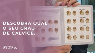 Descubra qual o seu grau de calvície