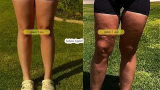 اللي مش متاح ليها تروح چيم وعندها سيلوليت او ليبوديما تركز معايا