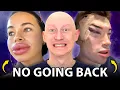 Plastic Surgery Is RUINING Your Face