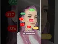 Acupuncture Points for Bell s Palsy