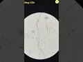 Download Lagu Condom Under Microscope | TULO - Microscope #shorts #underthemicroscope #condom