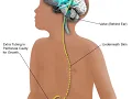 Shuntogram CPT code - simplify medical coding