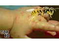 Download Lagu Top 10 Insects You Don’t Want To Get Stung By