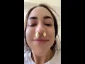 Download Lagu Woman shares viral hack for clearing sinuses by putting GARLIC up her NOSE