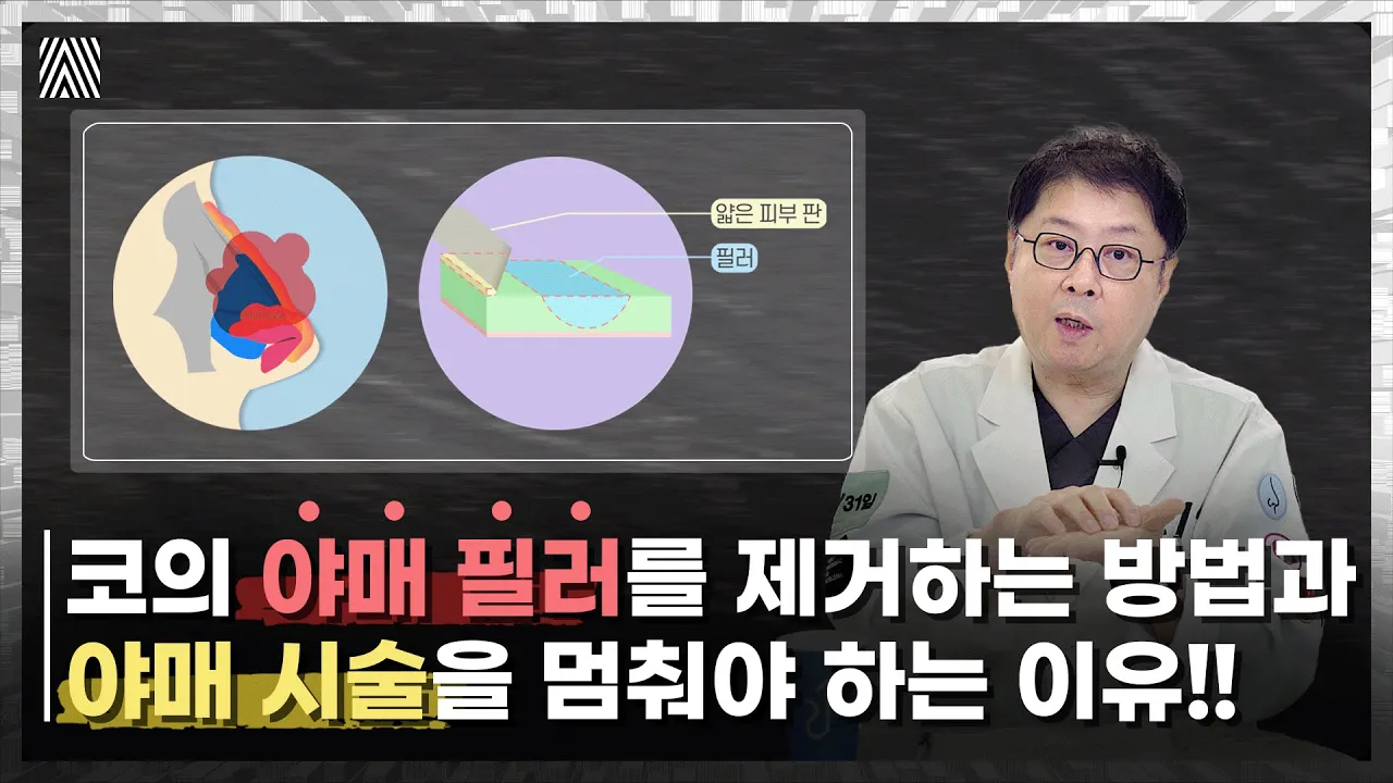 코에 넣은 '야매 필러'.. 야매 시술, 정말 해도 괜찮을까?? 야매 필러 2편_[4월31일 성형외과]
