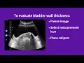 Vscan Air Using presets for evaluations bladder