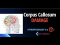 Pathophysiology for Nursing Corpus Callosum and the Nervous System