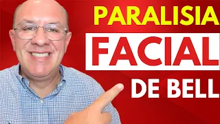 Paralisia Facial de Bell: Causas, Sintomas e Tratamento Explicado! [AULA COMPLETA]