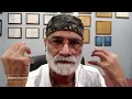 Dr Pradip Jamnadas on loose skin and water fasting
