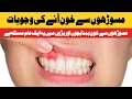 Causes of bleeding gums Daily Jang